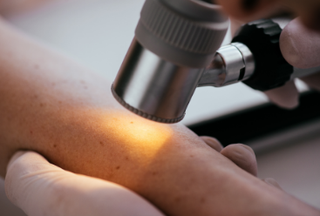 Use of a teledermatology platform to reduce dermatology referrals to secondary care